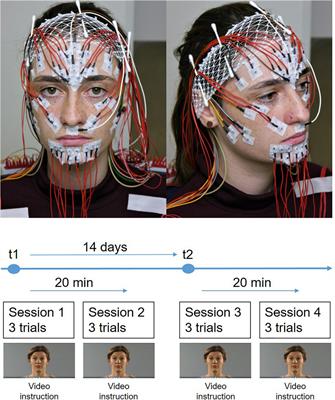 Test-retest reliability of high-resolution surface electromyographic activities of facial muscles during facial expressions in healthy adults: A prospective observational study